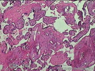 胎盘图36