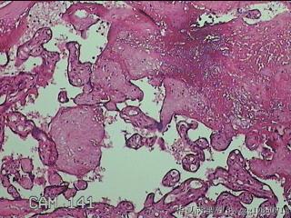 胎盘图30