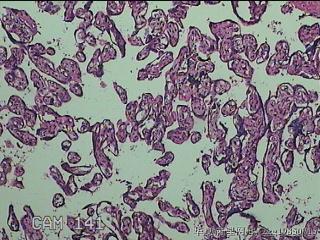 胎盘图43