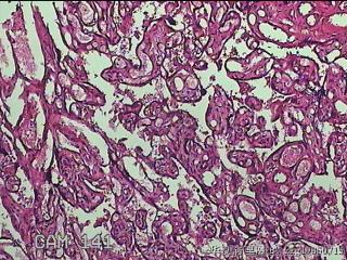 胎盘图18