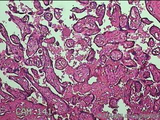 胎盘图26