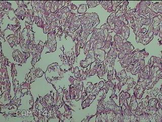 胎盘图39
