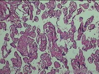 胎盘图42