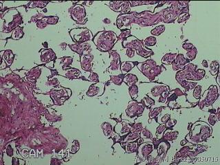 胎盘图41