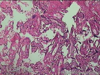 胎盘图20