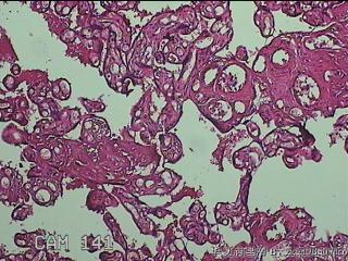 胎盘图13