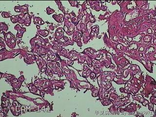 胎盘图14