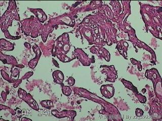 胎盘图29