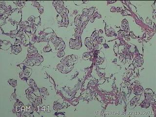 胎盘图7
