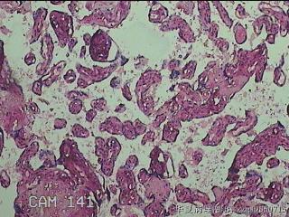 胎盘图33