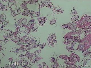 胎盘图8