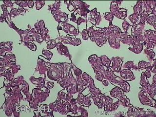 胎盘图15