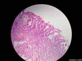 胃窦活检组织图13