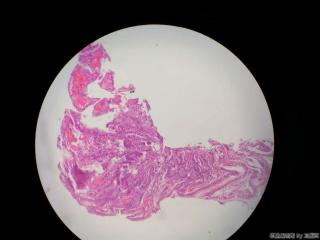胃窦活检组织图11