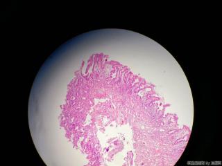 胃窦活检组织图12