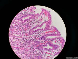 胃窦活检组织图9