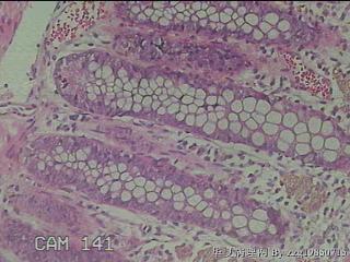 直肠粘膜图15