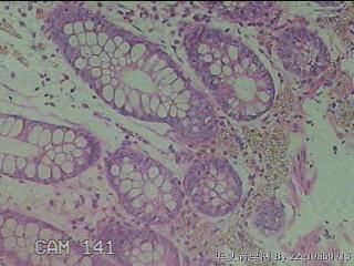 直肠粘膜图29