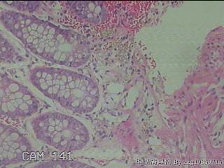 直肠粘膜图34