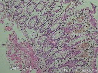 直肠粘膜图1