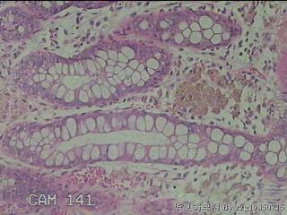 直肠粘膜图14