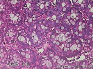 乙状结肠粘膜图18