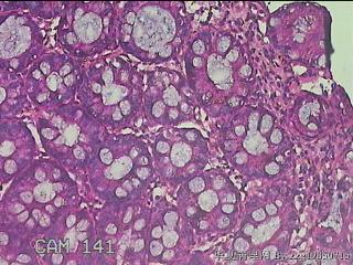 乙状结肠粘膜图15