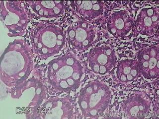 乙状结肠粘膜图48