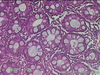 乙状结肠粘膜图41