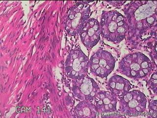 乙状结肠粘膜图26