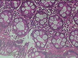 乙状结肠粘膜图47