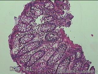 乙状结肠粘膜图8