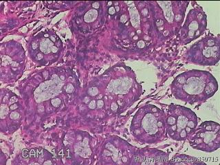 乙状结肠粘膜图20