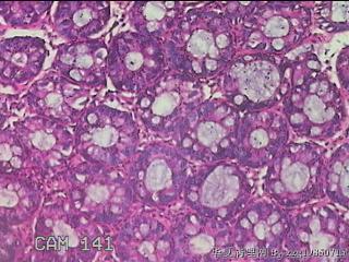 乙状结肠粘膜图19