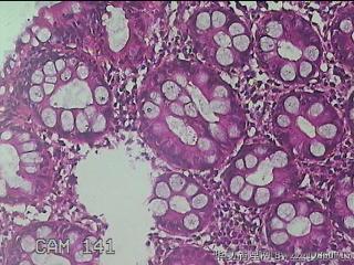 乙状结肠粘膜图49