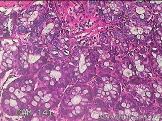 乙状结肠粘膜图25
