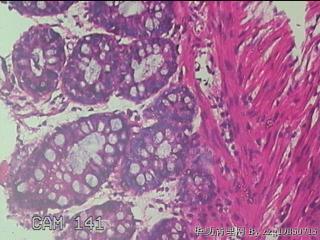 乙状结肠粘膜图35