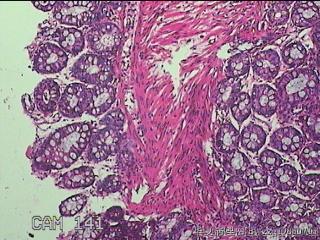 乙状结肠粘膜图6