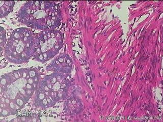 乙状结肠粘膜图30