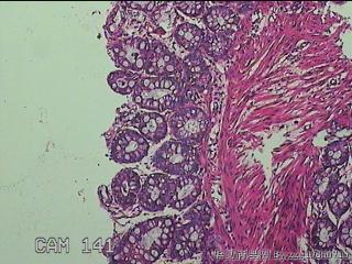 乙状结肠粘膜图7