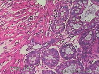 乙状结肠粘膜图27