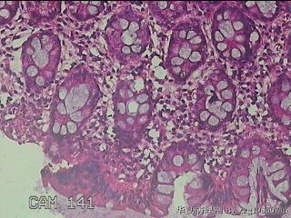 乙状结肠粘膜图23