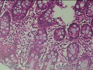 乙状结肠粘膜图24