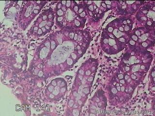 乙状结肠粘膜图32