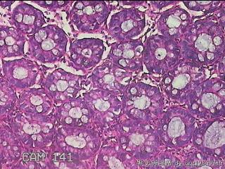 乙状结肠粘膜图21