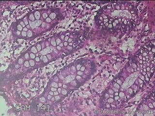 乙状结肠粘膜图38