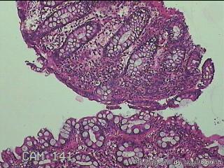 乙状结肠粘膜图9