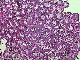 乙状结肠粘膜图1
