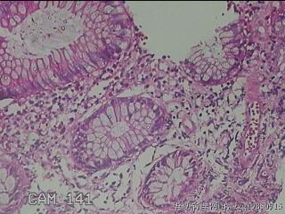 盲肠粘膜图41