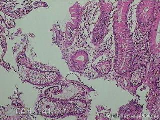 盲肠粘膜图11